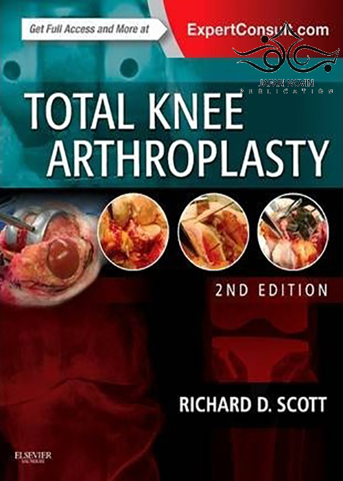 Total Knee Arthroplasty, 2nd Edition2014 آرتروپلاستی کامل زانو Saunders