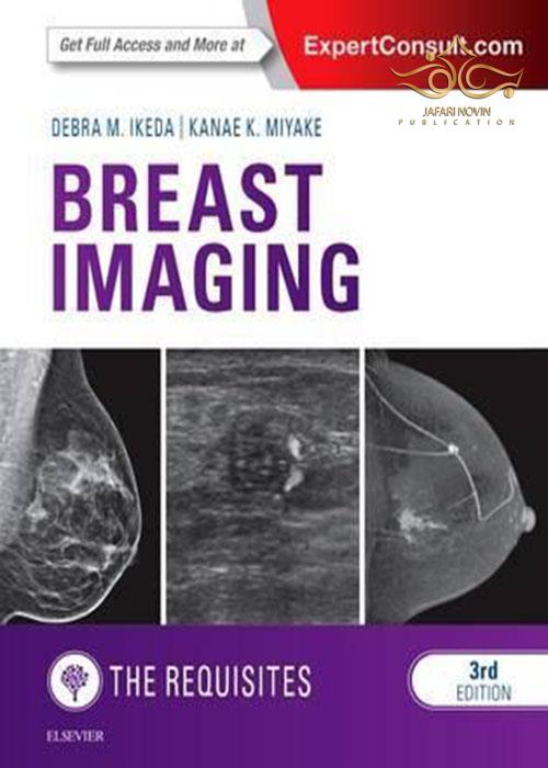 Breast Imaging: The Requisites ELSEVIER