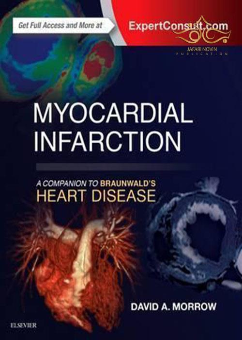 Myocardial Infarction: A Companion to Braunwald