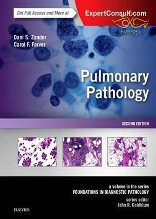 Pulmonary Pathology : A Volume in the Series: Foundations in Diagnostic Pathology ELSEVIER