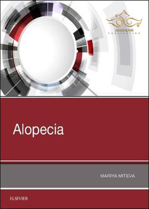 Alopecia ELSEVIER