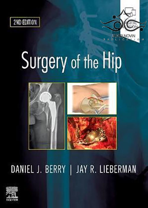 Surgery of the Hip: 2nd Edition2019 جراحی مفصل ران: مشاوره متخصص ELSEVIER