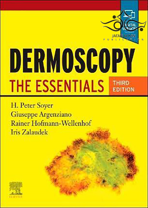 Dermoscopy: The Essentials, 3rd Edition ELSEVIER