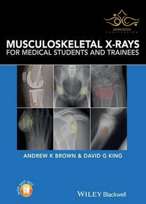 Musculoskeletal X-Rays for Medical Students and Trainees John Wiley-Sons