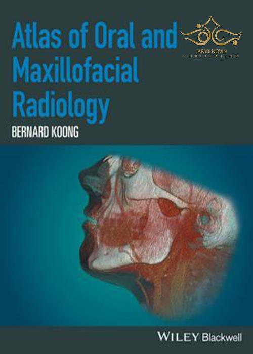 Atlas of Oral and Maxillofacial Radiology John Wiley-Sons