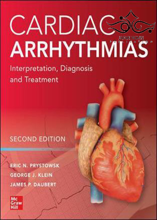 Cardiac Arrhythmias: Interpretation, Diagnosis and Treatment, Second Edition 2nd Edition 2020 McGraw-Hill Education