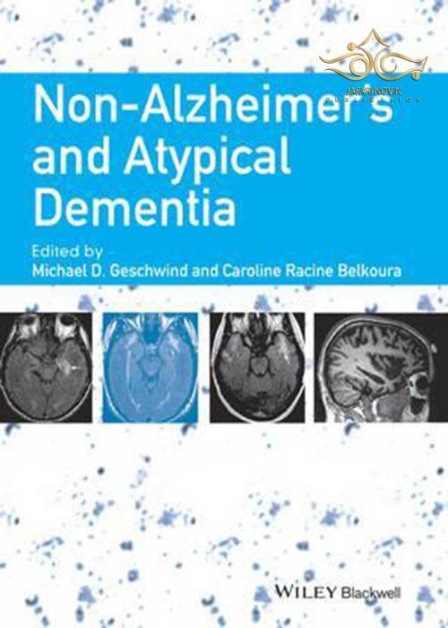 Non-Alzheimer's and Atypical Dementia John Wiley-Sons