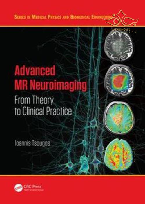 Advanced MR Neuroimaging : From Theory to Clinical Practice Taylor- Francis Inc