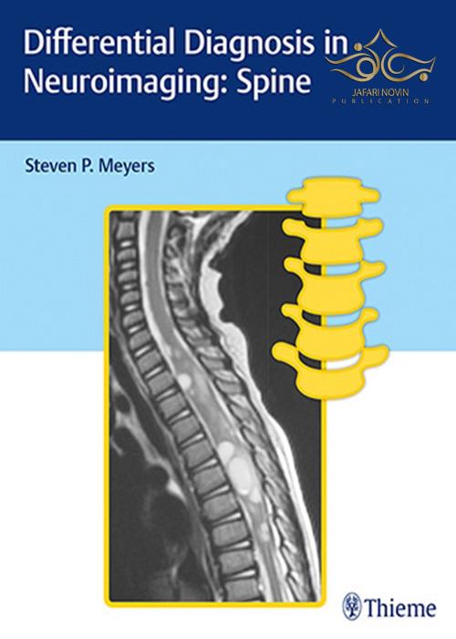 Differential Diagnosis in Neuroimaging: Spine 1st Edición Thieme