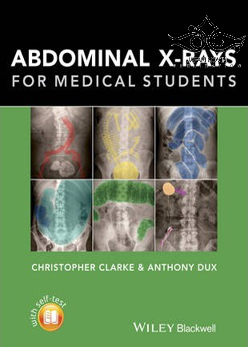 Abdominal X-rays for Medical Student2015 John Wiley-Sons Inc