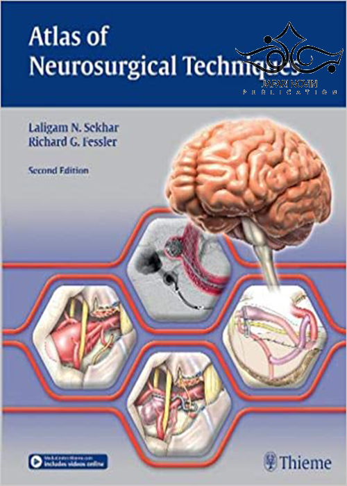 Atlas of Neurosurgical Techniques: Brain 2nd Edición Thieme