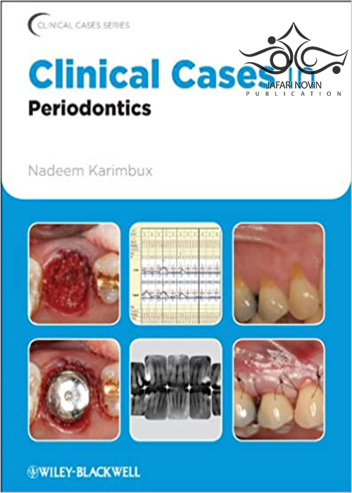 Clinical Cases in Periodontics (Clinical Cases (Dentistry) Book 42) 1st Edition موارد بالینی در پریودنتیکس Iowa State University Press