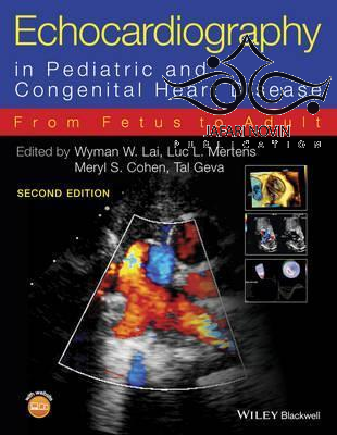 Echocardiography in Pediatric and Congenital Heart Disease, 2nd Edition2016 اکوکاردیوگرافی در بیماری های قلب و مادرزادی قلب John Wiley-Sons Inc