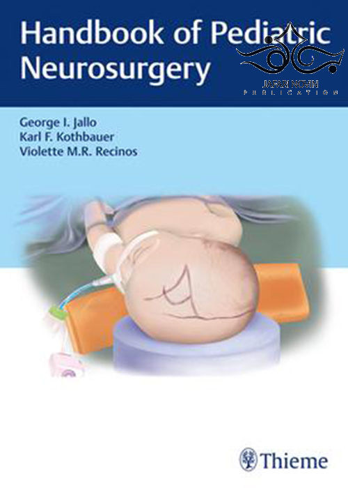 Handbook of Pediatric Neurosurgery 1st Edition2018 Thieme