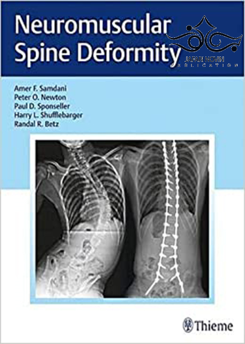 Neuromuscular Spine Deformity 1st Edition2018 تغییر شکل عضله عصبی عضلانی Thieme