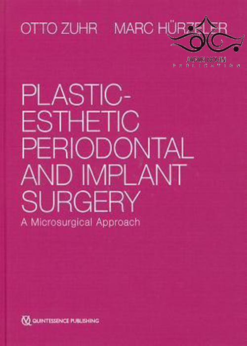 Plastic-Esthetic Periodontal and Implant Surgery  Quintessence Publishing Co Inc.,U.S