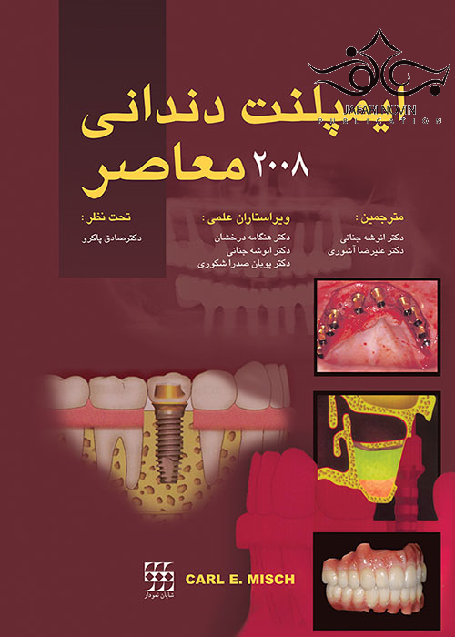 ایمپلنت دندانی معاصر میش 2008 2جلدی شایان نمودار