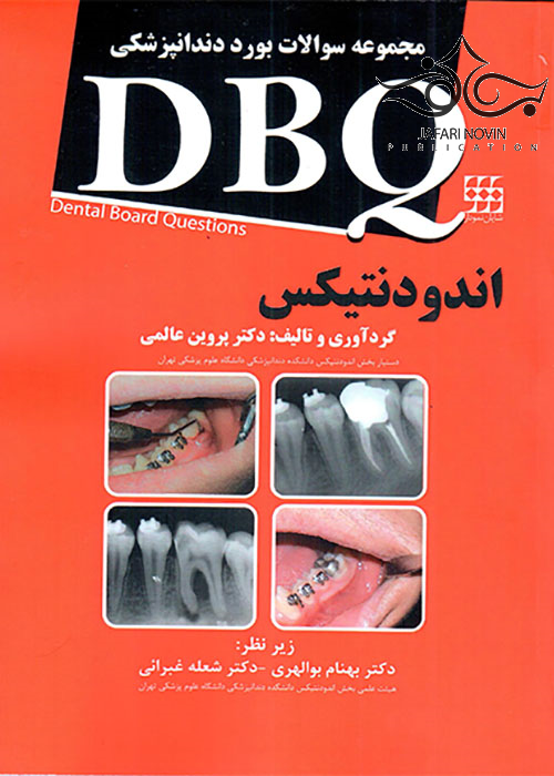 DBQ مجموعه سوالات بورد دندانپزشکی اندودنتیکس شایان نمودار