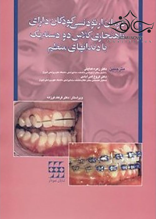 درمان ارتودنسی کودکان دارای ناهنجاری کلاس دو دسته یک با دندانهای منظم شایان نمودار