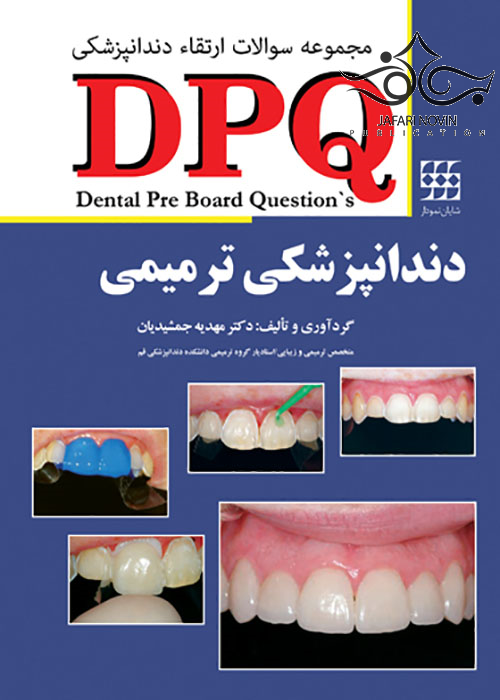 DPQ مجموعه سوالات ارتقاء دندانپزشکی دندانپزشکی ترمیمی شایان نمودار