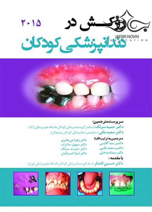 روکش در دندانپزشکی کودکان 2015 رویان پژوه