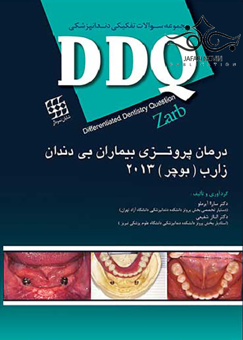 DDQ مجموعه سوالات تفکیکی دندانپزشکی درمان پروتزی بیماران بی دندان زارب بوچر 2013 شایان نمودار