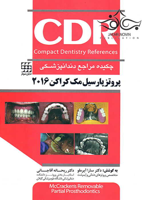CDR چکیده مراجع دندانپزشکی پروتز پارسیل مک کراکن 2016 شایان نمودار