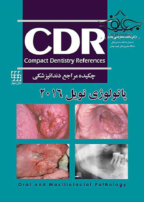 CDR چکیده مراجع دندانپزشکی پاتولوژی نویل 2016 شایان نمودار