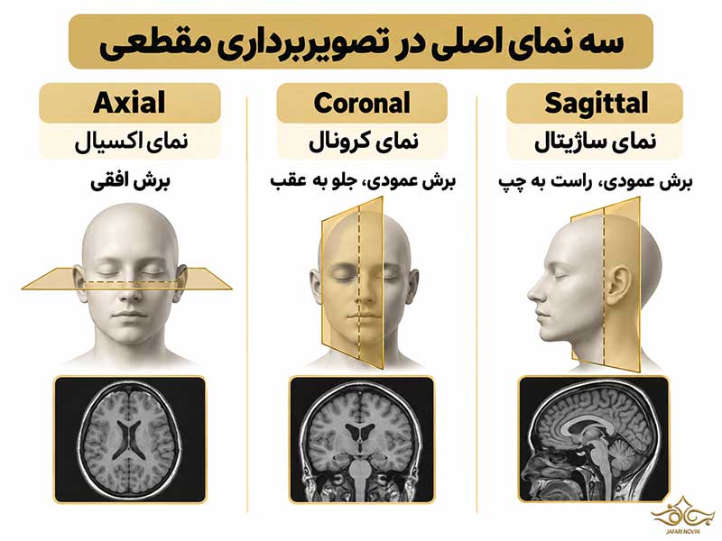 سه صفحه اصلی اکسیال، کرونال و ساژیتال در تصویربرداری مقطعی