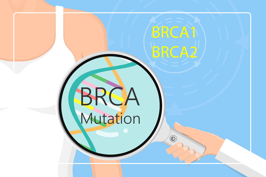 BRCA