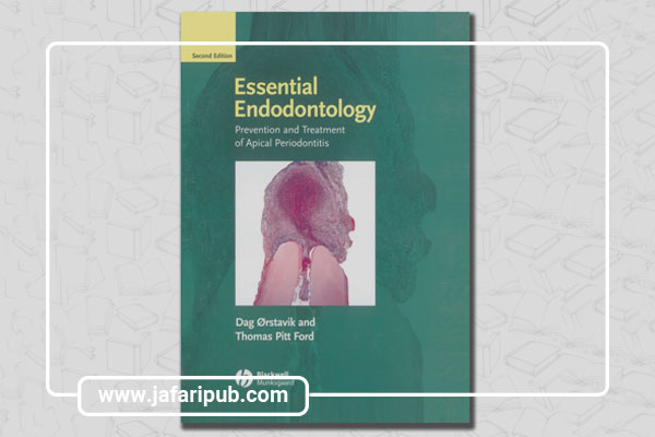 Essential Endodontology