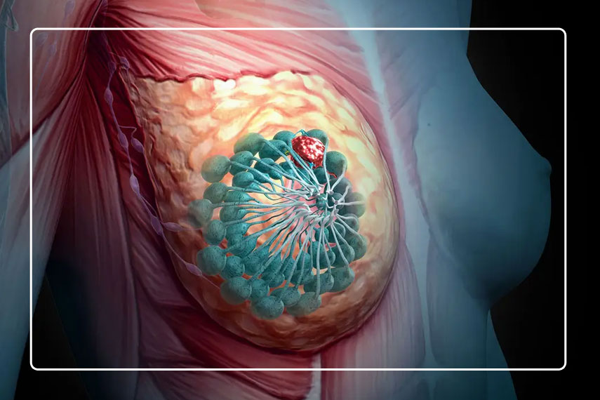 آنالیز CNV NGS