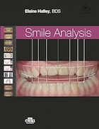 Smile Analysis | تحلیل لبخند