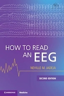 How to Read an EEG 2nd Edition | نحوه خواندن نوار مغزی (EEG) - ویرایش دوم