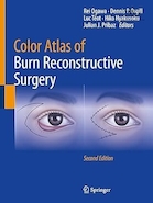 Color Atlas of Burn Reconstructive Surgery Second Edition | اطلس رنگی جراحی ترمیمی سوختگی، ویرایش دوم