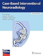 Case-Based Interventional Neuroradiology | نورورادیولوژی مداخله ای مبتنی بر مورد