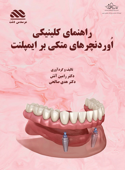 اُوردنچرهای متکی بر ایمپلنت