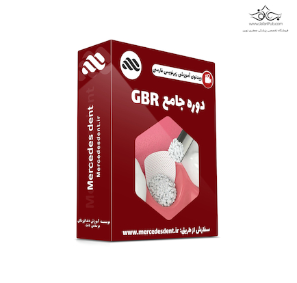 ویدئوی آموزشی بازسازی استخوان (GBR)