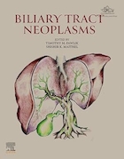 Biliary Tract Neoplasms 1st Edition | نئوپلاسم های مجاری صفراوی، ویرایش اول