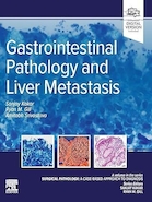 Gastrointestinal Pathology and Liver Metastasis | پاتولوژی دستگاه گوارش و متاستاز کبد
