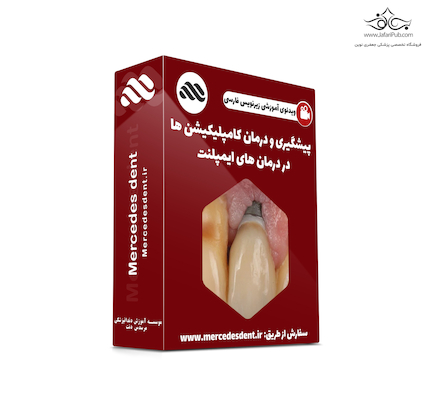 ویدئوی جامع پیشگیری و درمان کامپلیکیشن ها در درمان ایمپلنت