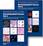 Haematolymphoid Tumours: WHO Classification of Tumours 5th Edition | تومورهای هماتولنفوئید: طبقه بندی تومورها توسط سازمان بهداشت جهانی، ویرایش پنجم