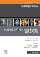 Imaging of the Small Bowel and Colon | تصویربرداری از روده کوچک و روده بزرگ