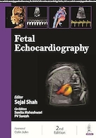 Fetal Echocardiography | اکوکاردیوگرافی جنین