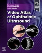 Video Atlas of Ophthalmic Ultrasound 1st Edition | اطلس ویدیویی سونوگرافی چشم، ویرایش اول