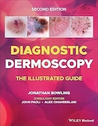 Diagnostic Dermoscopy: The Illustrated Guide 2nd Edition | درموسکوپی تشخیصی: راهنمای مصور، ویرایش دوم