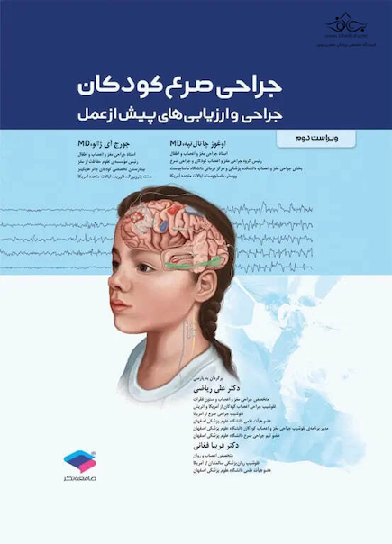 جراحی صرع کودکان جراحی و ارزیابی های پیش از عمل