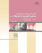 اطلس روشهای کاربردی کلینیکی سفید کردن دندان ها-بلیچینگ