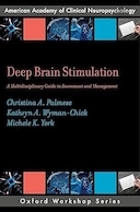 Deep Brain Stimulation | تحریک عمیق مغز