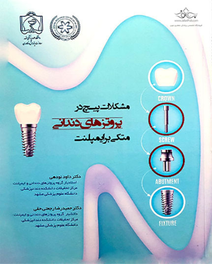 کتاب مشکلات پیچ در پروتزهای دندانی متکی بر ایمپلنت